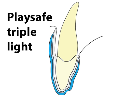 Playsafe triple light
